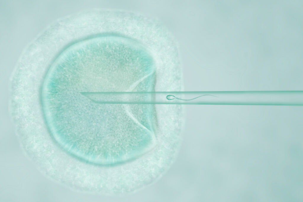 Procreazione Medicalmente Assistita