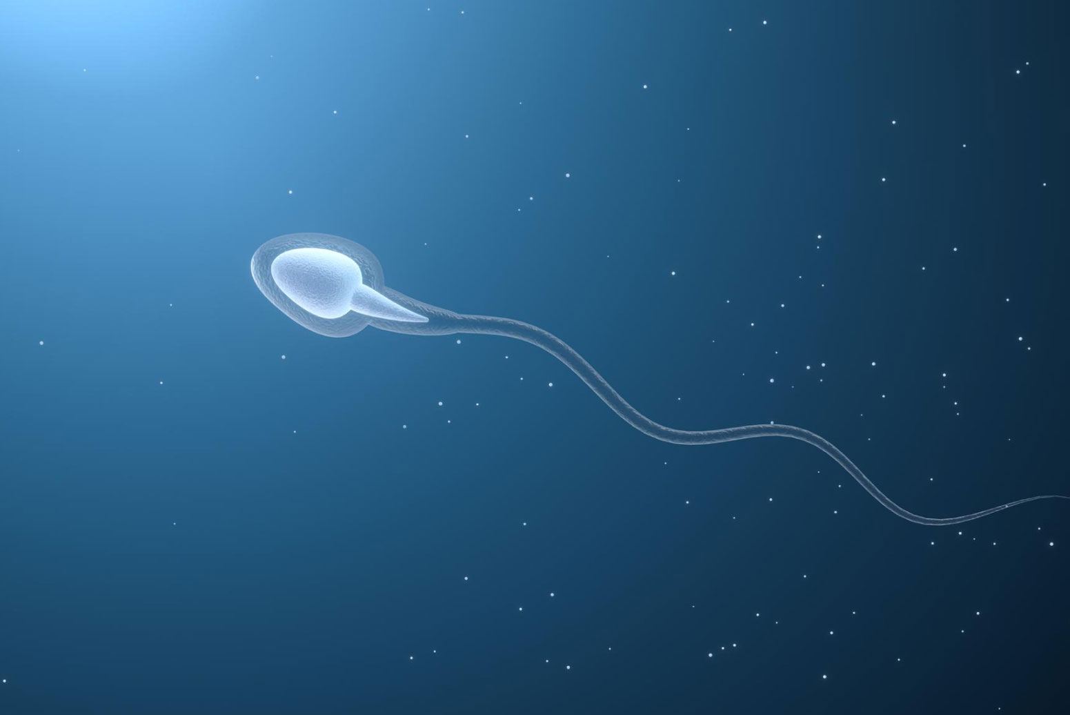Azoospermia